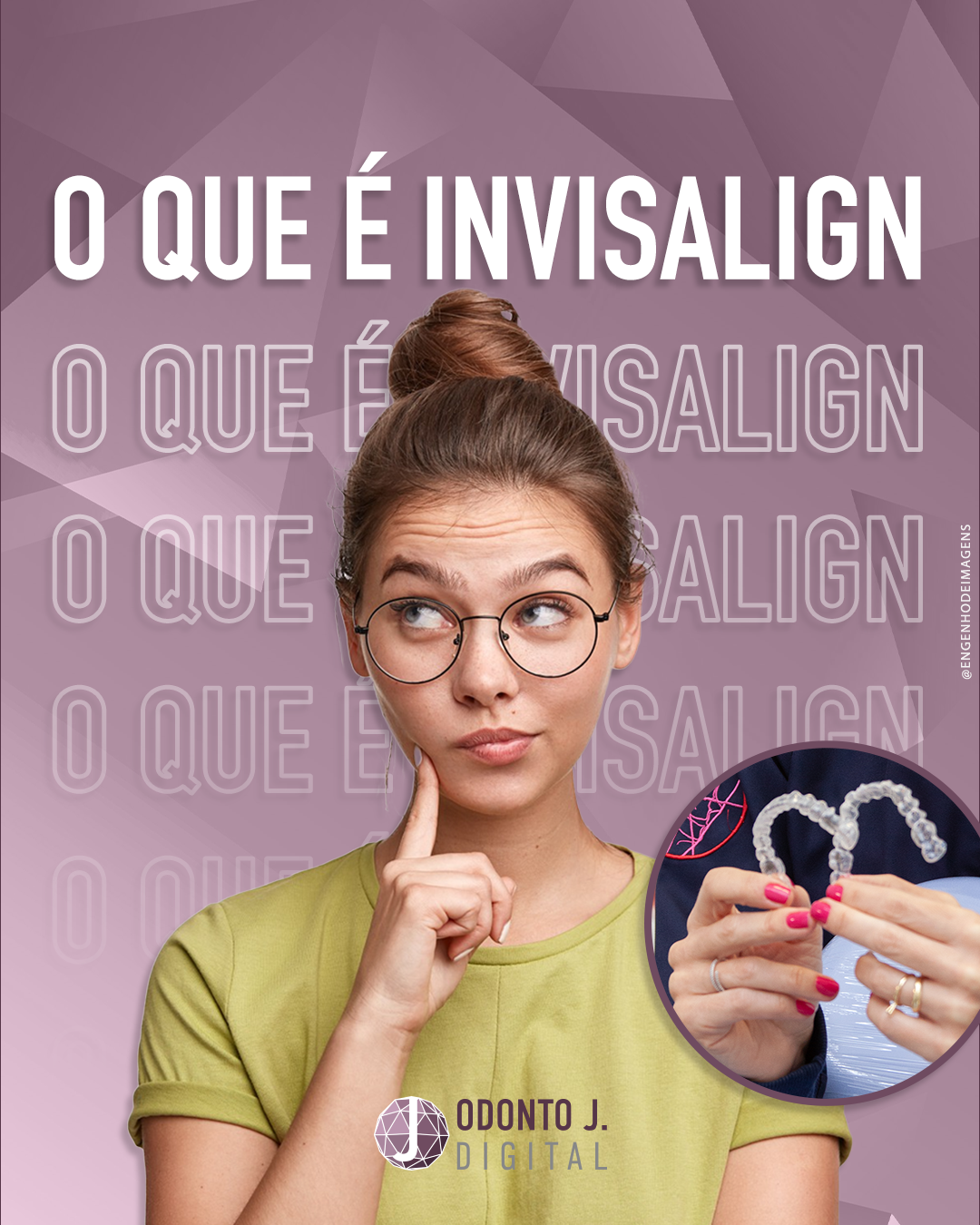 Apesar do Invisalign estar na moda e até na boca dos famosos, você já conhece?